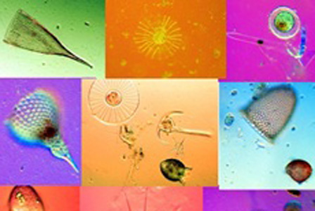 A variety of phytoplankton seen from a microscope